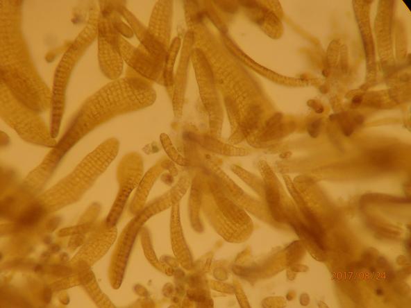 100x microscope image of "germling" sporophytes taken at the NOAA Ken Chew Center in Manchester, WA.  These are the young microscopic kelps that will grow into the Bull kelp canopy seaweed we recognize. Photo: Brian Allen